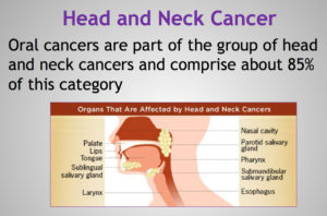 head-and-neck-cancer